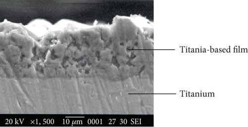 Why Titanium is the Top Choice for Medical Implants