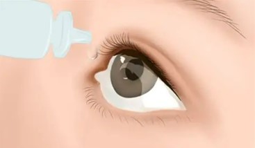 Eye Drop Ingredients for Dry Eye