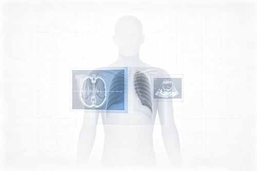 99.999% Yttrium Oxide Powder for Medical Imaging: Controlling Impurities at Production Scale